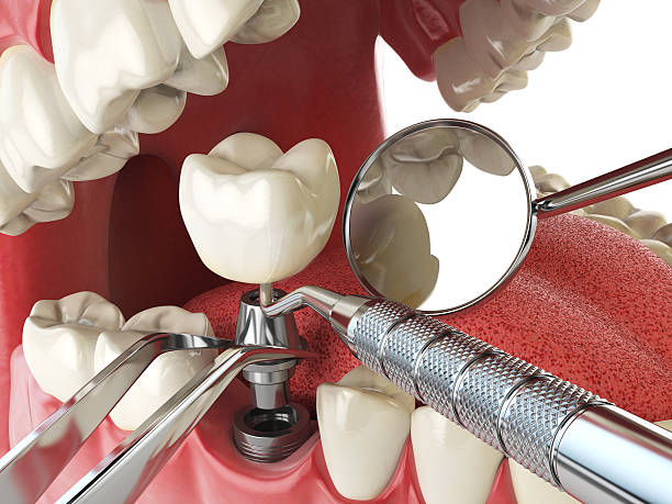 Best Cosmetic Emergency Dentistry in Lake Mary Jane, FL