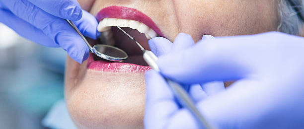 Best Emergency Treatment for Dental Infections or Abscesses in Lake Mary Jane, FL